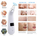 Blackhead Remover Vacuum Electric Blackhead Removal Tools Pore Cleaner with LED Display Deep Cleaner Blackhead Including 4 Patterns and 5 Suction Probes USB Rechargeable for Dry, Normal, Oily Skin
