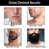 Beard Growth Kit,Beard Grooming Tools for Beard Rapid Growth and Density,Beard Growth Activator Serum +Beard Balm +Beard Cleanse, Beard Care Gift for Men Sandalwood Scent