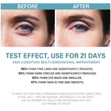 UNILIPO Peptide Eye Serum Moisturizes and Improves Puffiness. Caffeine Eye Serum Looks Like the Skin Around the Eyes is Shiny and Increases Skin Elasticity, 0.5oz / 15ml