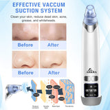 Blackhead Remover Vacuum, Pore Sucker Pimple Extractor Blackheads Vacume Suctioner Face Cleaner Tool Acne Whitehead Black heads Removal Kit with 4 Suction Probes & Heating Compress - USB Rechargeable