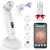 Blackhead Remover Vacuum, VITCOCO 5MP Visible Electric Facial Pore Cleanser Blackhead Suction Tool, 6 Modes & 4 Replaceable Suction Probes, LED Display, USB Rechargeable Blackhead Extractor Tool