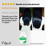 DHT Blocker Pills & Hair Supplement - Hair Growth Vitamins for Women & Men - Hair Loss Treatments for Women with Saw Palmetto
