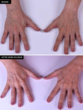 SilcSkin Hand Treatment