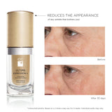 A MUST TRY! Deep Wrinkle Concentrate Serum for Lips Contour, Crow's Feet, Forehead and Mouth | Anti-Wrinkle Localized Skincare Concentrate Cream Serum, Proven Results - ULTIME EXPRESSION+ by IDC DERMO