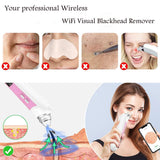 Blackhead Remover, Visual Electric Facial Pore Cleaner Phone Linked Display WiFi Beauty Device for Skin Care, Powerful Removal Blackhead Acne Extractor¡­