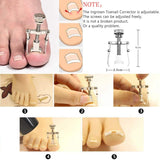 12PACK Ingrown Toenail Tool Ingrown Toenail Tool Kit Toenail Clippers Pedicure Tools Ingrown Toenail Nail Clipper Set Pedicure Kit Ingrown Toenail Pedicure Tool By JTIEO