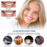 Teeth Whitening Kit, RENPHO 16XLED Accelerator Lights for Whitening Sensitive Teeth, 3X4ML Whitening Gels with 35% Carbamide Peroxide for Home System Use, NO need for batteries