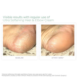 Glytone Ultra Softening Heel and Elbow Cream with 29.5 Free Acid Value Glycolic Acid & Glycerin, At-Home Pedicure, Exfoliate, Retexturize, Moisturize, Fragrance-Free, 1.7 oz.