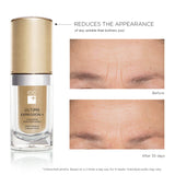 A MUST TRY! Deep Wrinkle Concentrate Serum for Lips Contour, Crow's Feet, Forehead and Mouth | Anti-Wrinkle Localized Skincare Concentrate Cream Serum, Proven Results - ULTIME EXPRESSION+ by IDC DERMO