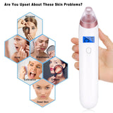 Blackhead Remover, Vacuum Blackhead Removal Peel Tool Extractor Electric Skin Pore Cleaner, Rechargeable Suction Comedone Acne Eliminator Microdermabrasion Device for Nose Face Men Women