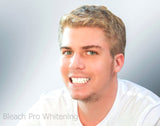 Teeth Whitening Gel 44% Carbamide Peroxide, 6 Tooth Bleaching Gel Syringe Dispensers 6 pcs