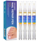 Fungus Stop, Biological Repair Pencil, Anti Fungus Nail Treatment, Toe Nails and Finger Nails Repair Pen, Fragile Nails Care Solution, Foot Therapy Antifungal Treatment