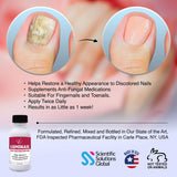 Luminail Nail Restoration Gel, Nail Softener, Nail Whitener, Topical Solution, for Fingernails and Toenails, Helps Nail Thickness and Discoloration