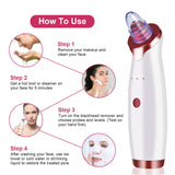 Blackhead Remover Vacuum Electric Pore Cleaner Blackhead Acne Comedone Pimple Extractor Tool Kit with 5 Replaceable Suction Probes, 3 Adjustable Suction Power
