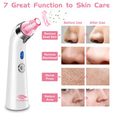 Blackhead Remover Pore Vacuum - Electric Blackhead Vacuum Cleaner Blackhead Extractor Tool Device Comedo Removal Suction Beauty Device for Women（Pink)