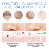 Blackhead Remover Vacuum Electric Blackhead Removal Tools Pore Cleaner with LED Display Deep Cleaner Blackhead Including 4 Patterns and 5 Suction Probes USB Rechargeable for Dry, Normal, Oily Skin