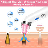Blackhead Remover Pore Vacuum - Electric Blackhead Vacuum Cleaner Blackhead Extractor Tool Device Comedo Removal Suction Beauty Device for Women（Pink)