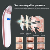 Blackhead Remover, Vacuum Blackhead Removal Peel Tool Extractor Electric Skin Pore Cleaner, Rechargeable Suction Comedone Acne Eliminator Microdermabrasion Device for Nose Face Men Women