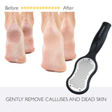 Foot File, Callus Remover, STEINDER 234 Incredible Foot File, Foot File Callus Remover, Foot Pedicure Foot Rasp for Hygenic & Safe & Foot Grater, Designed for Comfort & Safety