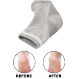 Runee Moisturizing Gel Heel Socks Open Toe For Dry, Hard, Rough, And Cracked Skin - Treatment Care For Softer Heel, 3 Pair