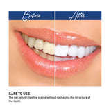 Vivostar Teeth Whitening Kit, (3)3ml Whitening Gel, (1)3ml Desensitizing Gel,Premium Quality,Made for the sensitive smile