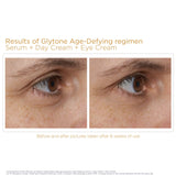 Glytone Age- Defying Antioxidant Eye Cream, 0.5 fl. oz