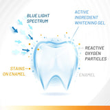 White Glo Accelerator Teeth Whitening Kit with LED Light for Sensitive Teeth and Gums - Carbamide Peroxide, Papaya and Pineapple Enzymes for Best Teeth Whitening Results - 10 Min Timer & 50 Uses!
