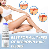Razor Bump Stopper Solution for Ingrown Hair - Skin Care Treatment for Face, Neck, Bikini Area, Legs and Underarm Area - After Shave Serum for Men and Women - With Salicylic Acid, Glycolic Acid