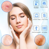 Blackhead Remover Vacuum, Pore Sucker Pimple Extractor Blackheads Vacume Suctioner Face Cleaner Tool Acne Whitehead Black heads Removal Kit with 4 Suction Probes & Heating Compress - USB Rechargeable