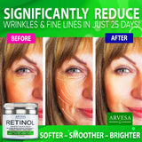 Anti Aging Retinol Moisturizer Cream for Face, Neck & Décolleté - Made in USA - Wrinkle Cream for Women and Men with Hyaluronic Acid and Active Retinol 2.5% - Day and Night - Results in 4 Weeks