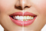 Isabella’s Clearly GLOW COCONUT (BULK) Teeth Whitening Activated Charcoal 100% Pure Food Grade Non-GMO. Better than Strips,Toothpaste, Bleach. Removes Stains, Plaque. USA (100g, 12 Months Supply)