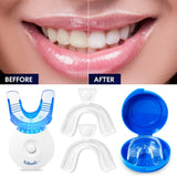 VieBeauti Teeth Whitening Kit - 5X LED Light Tooth Whitener with 35% Carbamide Peroxide, Mouth Trays, Remineralizing Gel and Tray Case - Built-In 10 Minute Timer Restores Your Gleaming White Smile