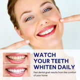 VieBeauti Teeth Whitening Kit - 5X LED Light Tooth Whitener with 35% Carbamide Peroxide, Mouth Trays, Remineralizing Gel and Tray Case - Built-In 10 Minute Timer Restores Your Gleaming White Smile