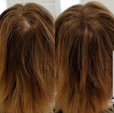 Evolution Hair Fibers -100% Human Hair Fibers - Deluxe 38g Med Brown - For Men & Women - Conceal Thinning Hair in Seconds!