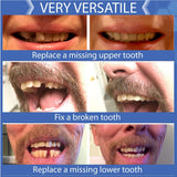 Multi-Shade Temporary Tooth Replacement Kit with box of Tooth Replacement Fitting Beads - BUNDLE