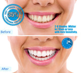 Always White Teeth Whitening Gel Kit Tooth Whitening Trays LED Light Tooth Whitening with 35% Carbamide Peroxide (3) Fast Acting ALL-IN-ONE Kit with FREE Month.
