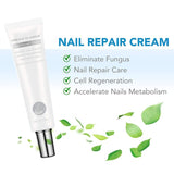 Toenail Fungus Treatment Cream, Nail Fungus Stop, Fingernail Fungus, Fungi Nail Fungus Remover, Maximum Strength Antifungal Cream