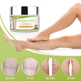 Varicose Veins Cream, Relief Phlebitis Angiitis Inflammation Blood Vein Veins Vasulitis Treatment