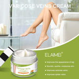 Varicose Veins Cream, Relief Phlebitis Angiitis Inflammation Blood Vein Veins Vasulitis Treatment